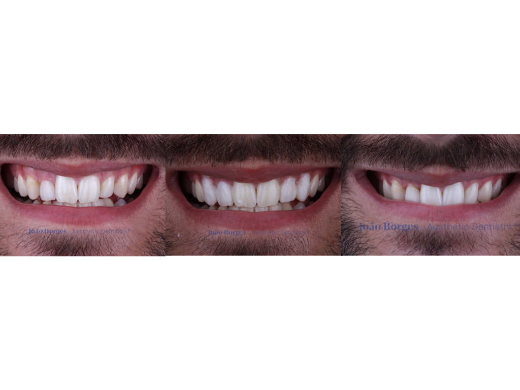 caso-clinico-saude-oral-2