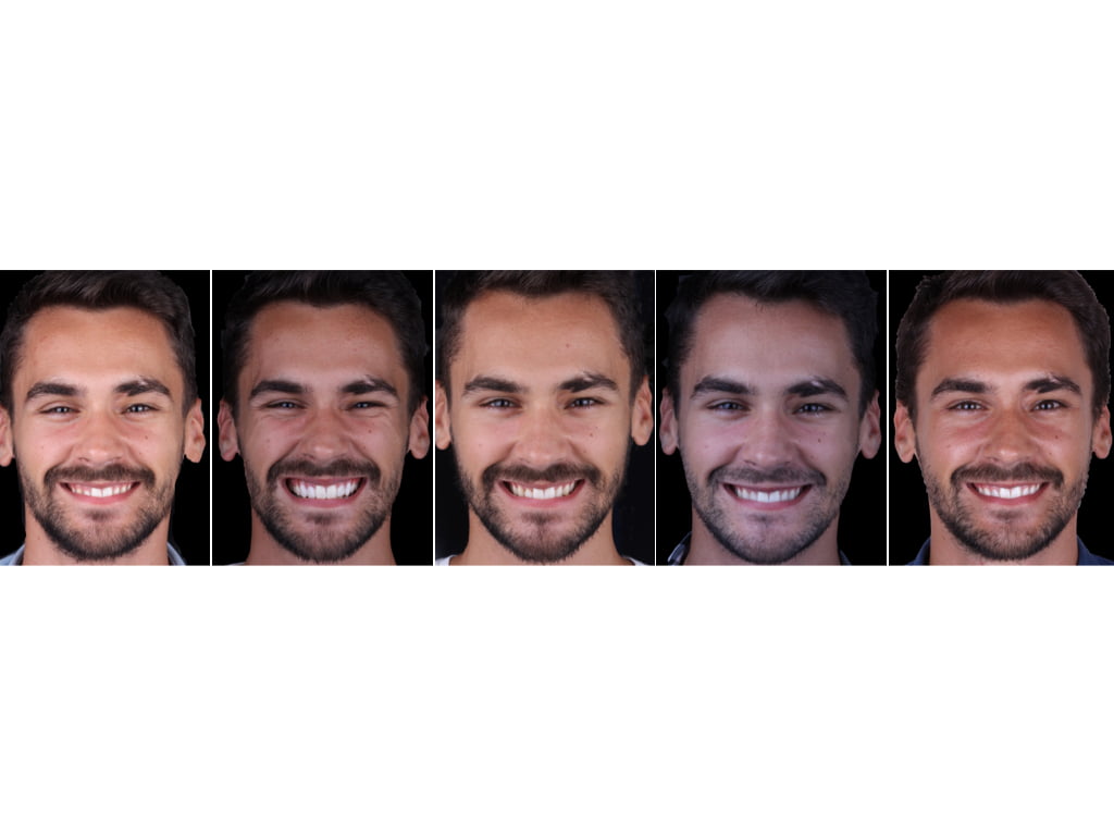 fotos-faciais-saude-oral