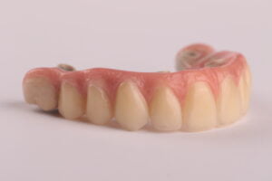 A aposta na técnica All-on-4 ® ganhou força com um estudo que pretende avaliar a viabilidade desta técnica com próteses Peek.